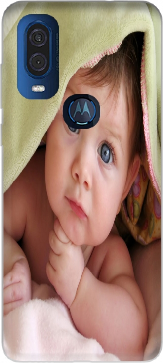 Hülle Motorola One Vision mit Bild baby