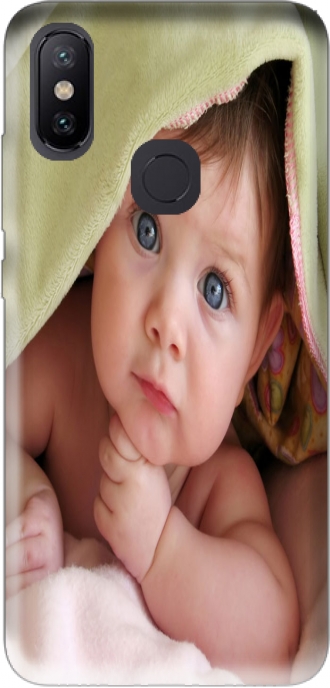 Hülle Xiaomi Mi A2 / Xiaomi 6x mit Bild baby