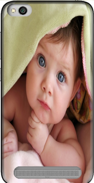 Hülle Xiaomi Redmi 5A mit Bild baby